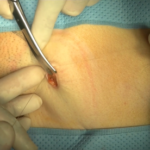 手術映像について