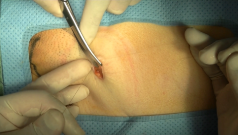 手術映像について