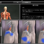 腰痛に3D動画を！